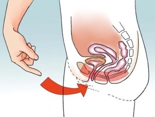 Pelvis Kası Faydaları Nelerdir?