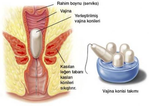 Pelvis Kas Glendirme