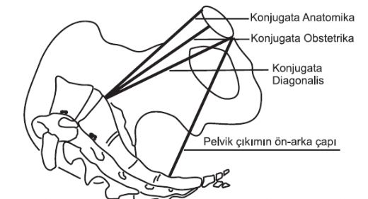 Pelvis Tipleri Pelvis Kemik Tipleri